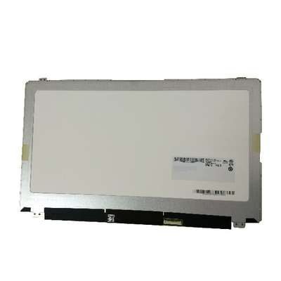 Des vertikaler Streifen-Laptops 15,6 RGB Note LCD 1366*7638 40pin B156XTT01.2