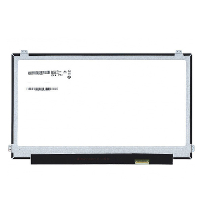 B156ZAN02.1 Größe 15,6 Zoll 16,7M 60Hz LCD-Müll für AUO